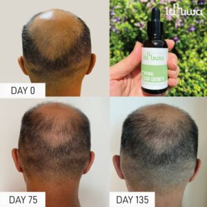 Lanuwa Natural Hair Growth essence (set of 3)- Vegan Hypoallergenic (3 bottles No.5)